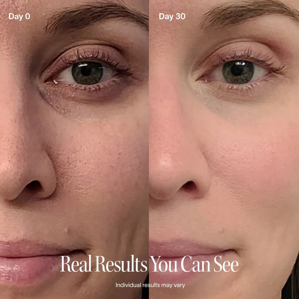 4-in-1 Red Light Therapy Wand & Activating Serum Kit | GC Retreat Edit™